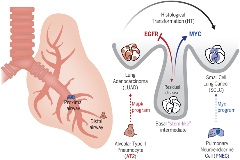 Science：新研究揭示肺腺癌向小细胞肺癌转变机制- 癌症研究专区- 生物谷