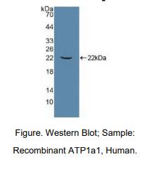 https://msimg.bioon.com/bionline/goods-no-pic.png