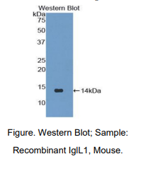 https://msimg.bioon.com/bionline/goods-no-pic.png