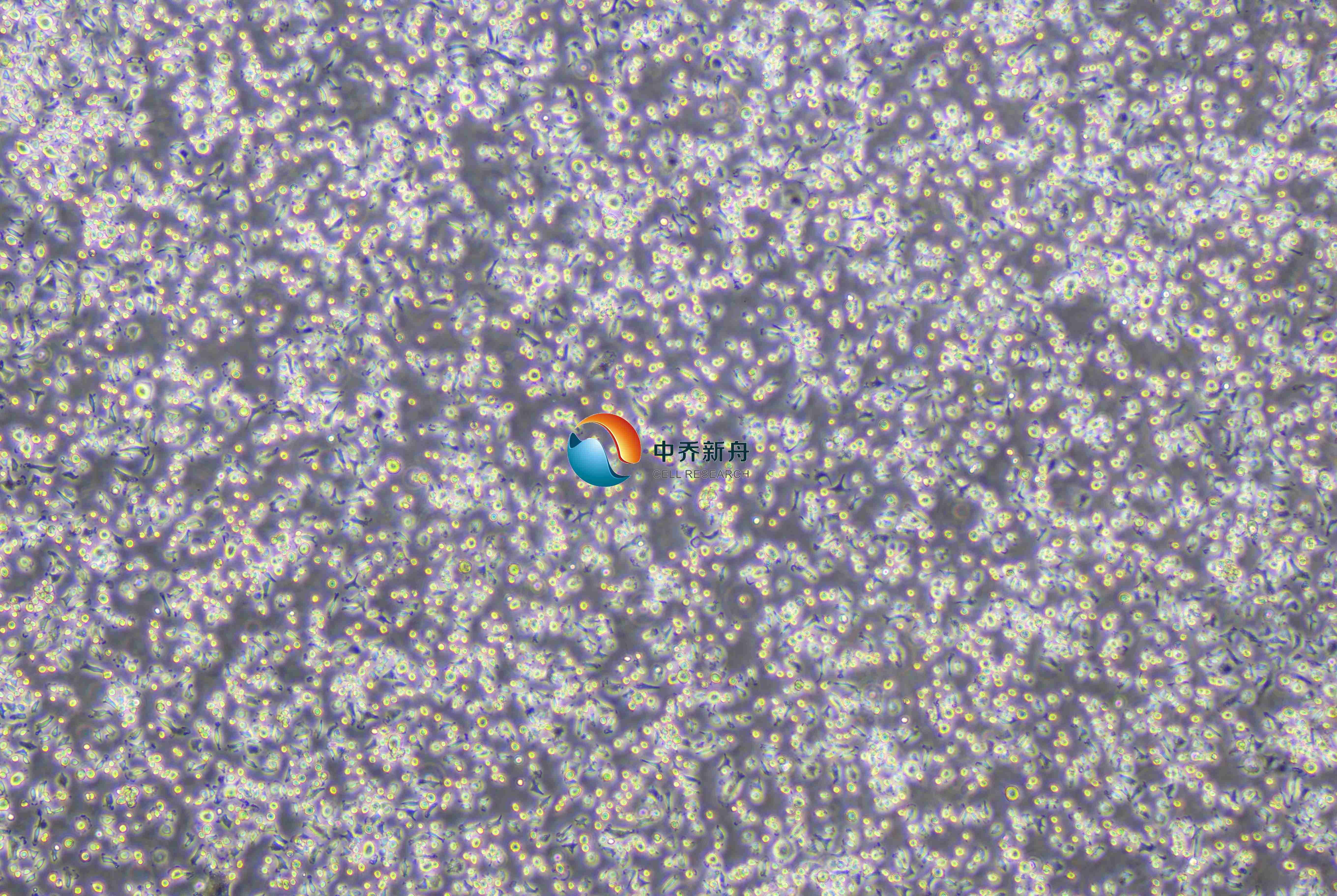 https://img.medsci.cn/8eee53bbc4cb7a98de615e72115896bc4e27fda5cbb764dbd67d9d641c2bb46a.png