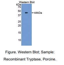 https://msimg.bioon.com/bionline/goods-no-pic.png