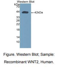 人无翅型MMTV整合位点家族成员2(WNT2)多克隆抗体