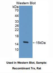 https://msimg.bioon.com/bionline/goods-no-pic.png