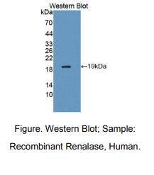 https://msimg.bioon.com/bionline/goods-no-pic.png