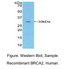 人乳腺癌易感蛋白2(BRCA2)多克隆抗体