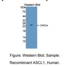 https://msimg.bioon.com/bionline/goods-no-pic.png