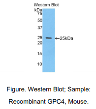 https://msimg.bioon.com/bionline/goods-no-pic.png