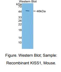 小鼠吻素1(KISS1)多克隆抗体