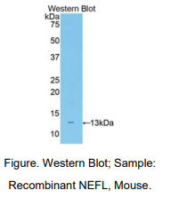 小鼠轻肽神经丝蛋白(NEFL)多克隆抗体