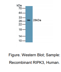 https://msimg.bioon.com/bionline/goods-no-pic.png