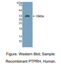 https://msimg.bioon.com/bionline/goods-no-pic.png