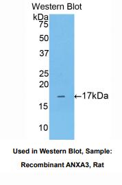 https://msimg.bioon.com/bionline/goods-no-pic.png