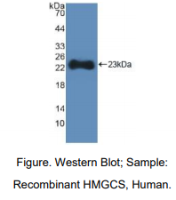 人羟甲基戊二酰辅酶A合酶(HMGCS)多克隆抗体