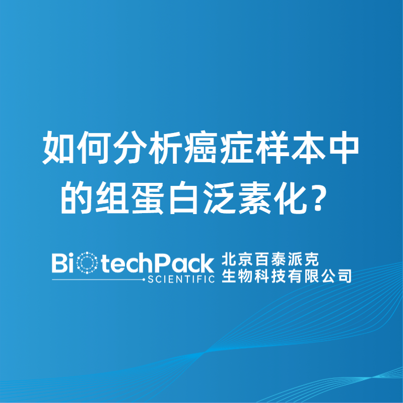 如何分析癌症样本中的组蛋白泛素化？