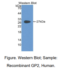 https://msimg.bioon.com/bionline/goods-no-pic.png