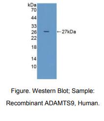 https://msimg.bioon.com/bionline/goods-no-pic.png