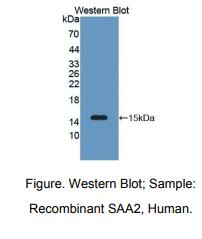 https://msimg.bioon.com/bionline/goods-no-pic.png