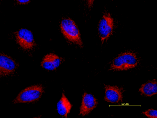 https://img.medsci.cn/e73eefcea40976357f460123cbf1e819c54e5106c9b457225be13b1cbc991aff.png