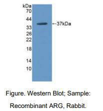 兔精氨酸酶(ARG)多克隆抗体