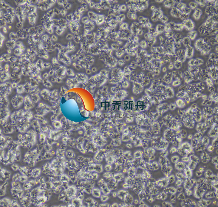 LS1034人结肠腺癌细胞（STR鉴定）