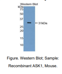 https://msimg.bioon.com/bionline/goods-no-pic.png