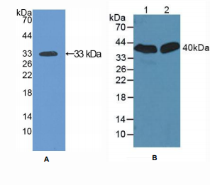 大鼠沉默调节蛋白2(SIRT2)多克隆抗体