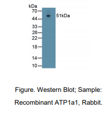 https://msimg.bioon.com/bionline/goods-no-pic.png