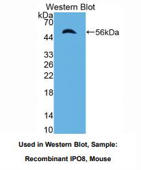 https://msimg.bioon.com/bionline/goods-no-pic.png