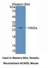 小鼠酰基辅酶A脱氢酶C2-C3短链(ACADS)多克隆抗体