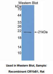 大鼠晶状体蛋白βB1(CRYbB1)多克隆抗体