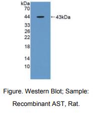 大鼠天冬氨酸转氨酶(AST)多克隆抗体