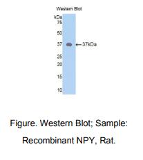 https://msimg.bioon.com/bionline/goods-no-pic.png