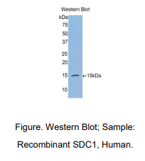 https://msimg.bioon.com/bionline/goods-no-pic.png