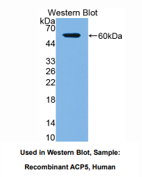 https://msimg.bioon.com/bionline/goods-no-pic.png