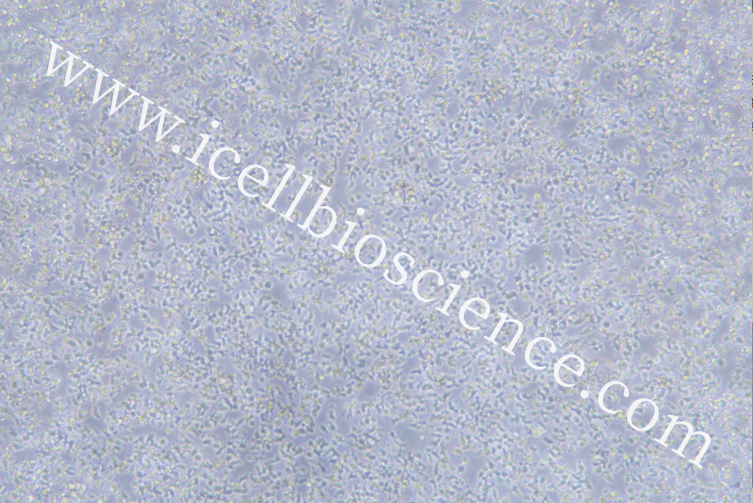 EL-4-B5细胞/EL4-B5细胞/EL-4B5细胞/EL4B5细胞/小鼠胸腺淋巴瘤细胞