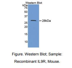 小鼠白介素9受体(IL9R)多克隆抗体