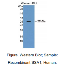 人干燥综合征抗原A1(SSA1)多克隆抗体