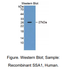 https://msimg.bioon.com/bionline/goods-no-pic.png