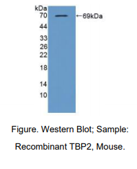 小鼠硫氧还蛋白互作蛋白(TXNIP)多克隆抗体