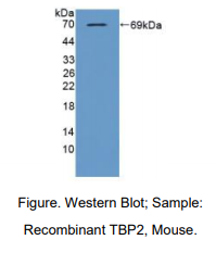 https://msimg.bioon.com/bionline/goods-no-pic.png