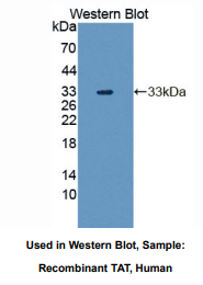 人酪氨酸转氨酶(TAT)多克隆抗体