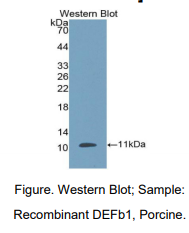 https://msimg.bioon.com/bionline/goods-no-pic.png