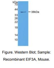 https://msimg.bioon.com/bionline/goods-no-pic.png