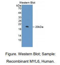 人肌球蛋白轻链6(MYL6)多克隆抗体