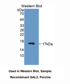 https://msimg.bioon.com/bionline/goods-no-pic.png