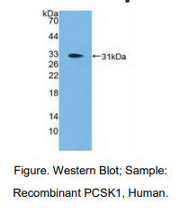 人前蛋白转化酶枯草溶菌素1(PCSK1)多克隆抗体