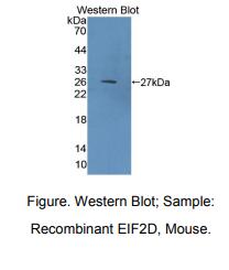 小鼠真核翻译起始因子2D(EIF2D)多克隆抗体