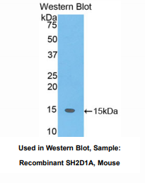 https://msimg.bioon.com/bionline/goods-no-pic.png