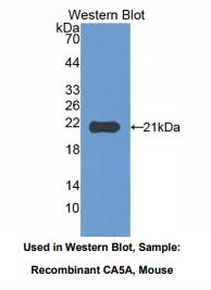 https://msimg.bioon.com/bionline/goods-no-pic.png