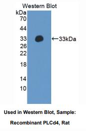 大鼠磷酯酶Cδ4(PLCd4)多克隆抗体